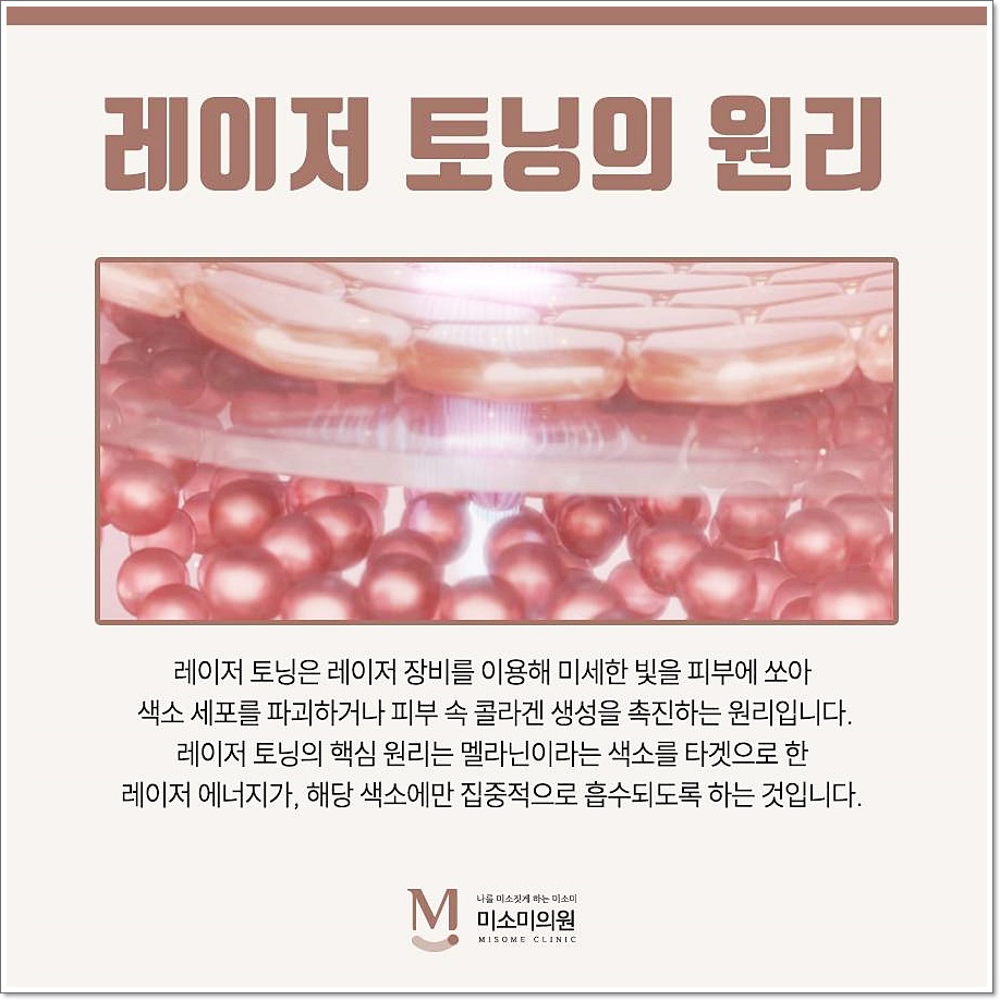 영등포피부과 개인별 피부 상태에 따른 맞춤형 기미 레이저 치료
