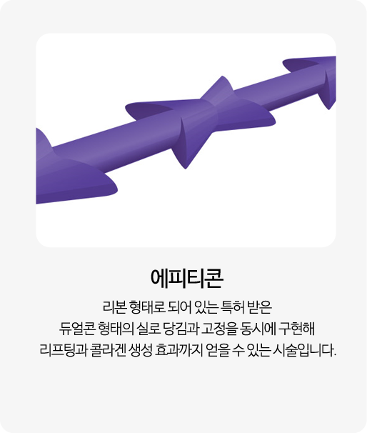 에피티콘